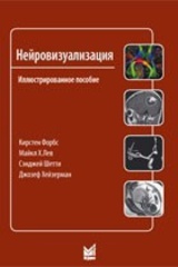 Нейровизуализация