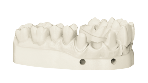Фотополимер NextDent Model 2.0