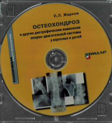 CD Остеохондроз и другие дистрофические изменения опорно-двигательной системы у взрослых и детей