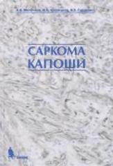 Саркома капоши