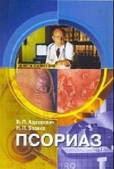 Псориаз