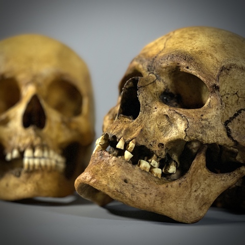 Женский череп человека азиатский + мужской череп человека европейский (анатомические модели)