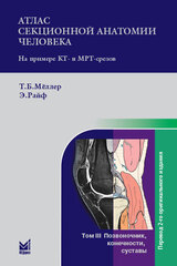 Атлас секционной анатомии человека на примере КТ- и МРТ-срезов Том 3. Позвоночник, конечности, суставы