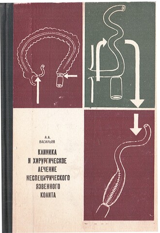Клиника и хирургическое лечение неспецифического язвенного колита