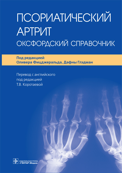 Псориатический артрит: современные рекомендации по лечению