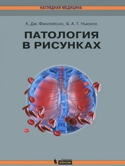 Патология в рисунках
