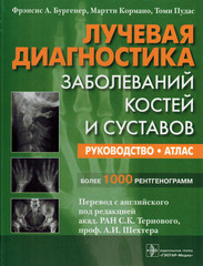 Лучевая диагностика заболеваний костей и суставов. Атлас-руководство