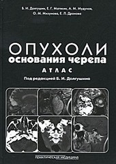 Опухоли основания черепа. Атлас