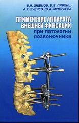 Применение аппарата внешней фиксации при патологии позвоночника