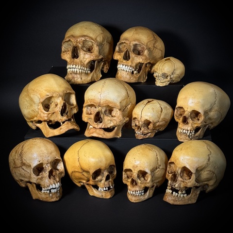 Набор «Череп человека» (анатомические модели)