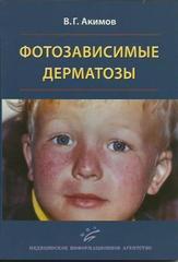 Фотозависимые дерматозы