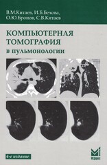 Компьютерная томография в пульмонологии