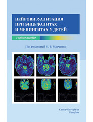 Нейровизуализация при энцефалитах и менингитах у детей