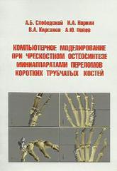 Компьютерное моделирование при чрескостном остеосинтезе миниаппаратами переломов коротких трубчатых костей