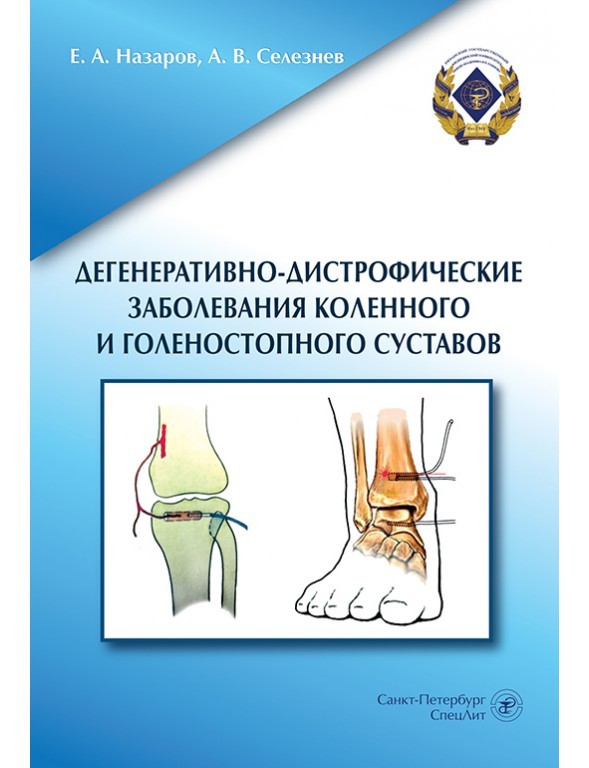 Метаболические заболевания костей и суставов