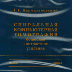 CD Спиральная компьютерная томография: болюсное контрастное усиление