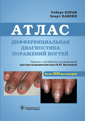 Дифференциальная диагностика поражений ногтей. Атлас