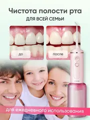 Ирригатор Soocas W3F, розовый