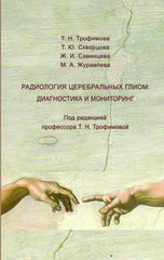 Радиология церебральных глиом: диагностика и мониторинг
