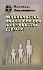 Неравенство длины нижних конечностей у детей