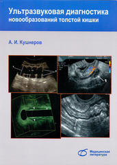 Ультразвуковая диагностика новообразований толстой кишки