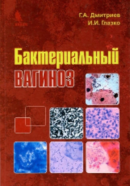 Какие микроорганизмы наиболее часто являются возбудителями бак вагиноза?