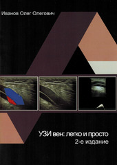 УЗИ вен:легко и просто. Simplified vein ultrasound