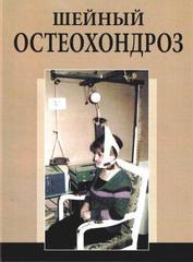 Шейный остеохондроз
