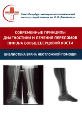 Современные принципы диагностики и лечения переломов пилона большеберцовой кости