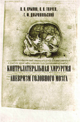 Контралатеральная хирургия аневризм головного мозга