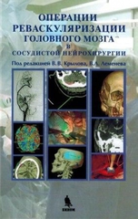 Операции реваскуляризации головного мозга в сосудистой нейрохирургии
