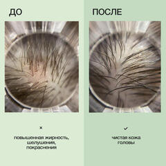 Limba Cosmetics Шампунь для жирной кожи головы DETOX OILY HAIR CLEANSING SHAMPOO ,300мл (lmb18)