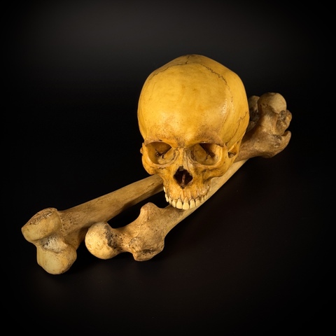 Череп человека без нижней челюсти в комплекте с бедренными костями (анатомические модели)