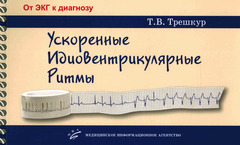Ускоренные идиовентрикулярные ритмы