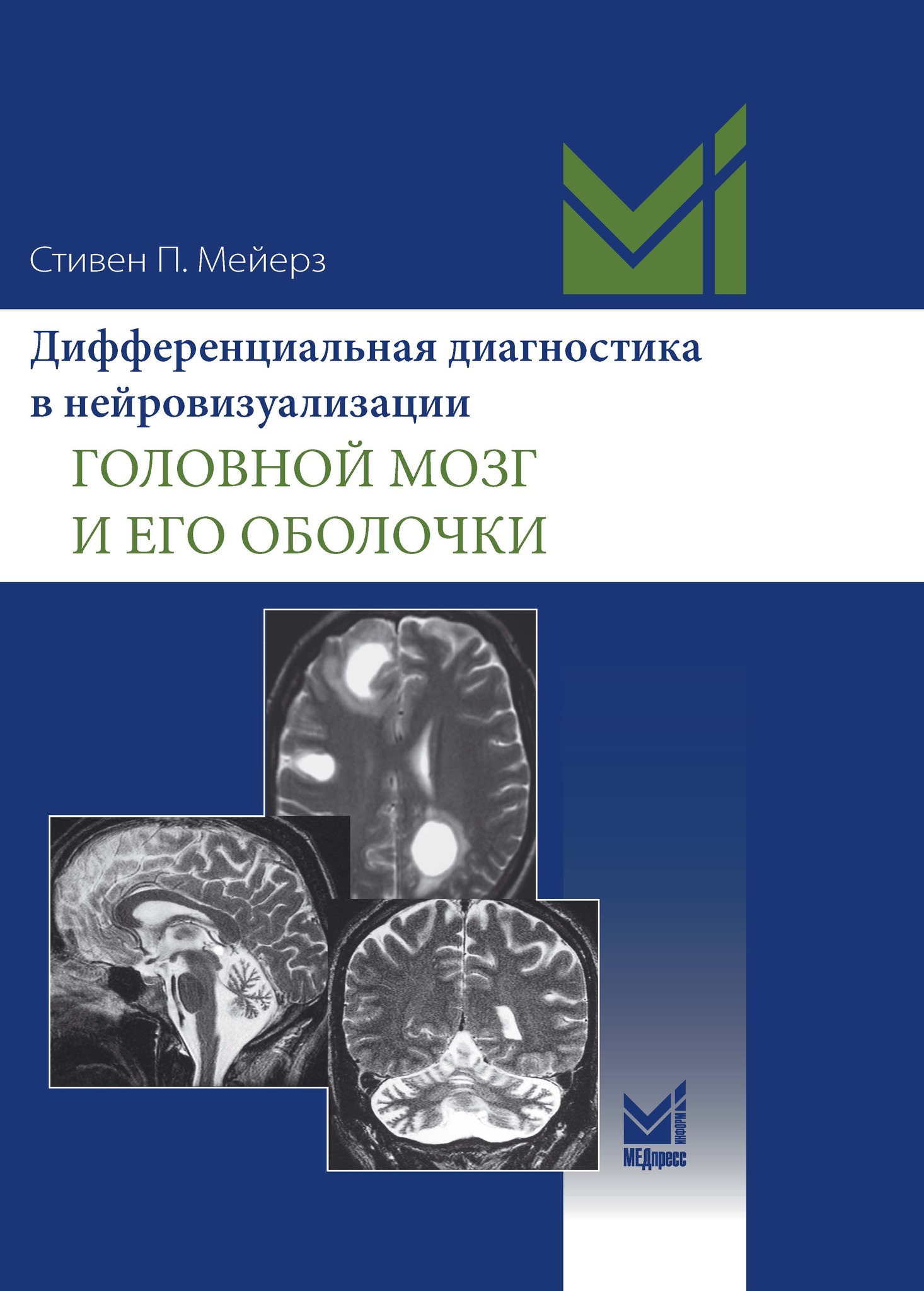 Дифференциальная диагностика в нейровизуализации. Головной мозг и его  оболочки