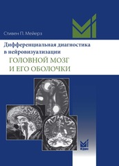 Дифференциальная диагностика в нейровизуализации. Головной мозг и его оболочки