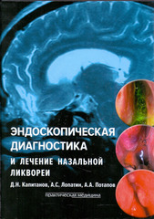 Эндоскопическая диагностика и лечение назальной ликвореи