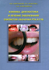 Клиника, диагностика и лечение заболеваний слизистой оболочки полости рта