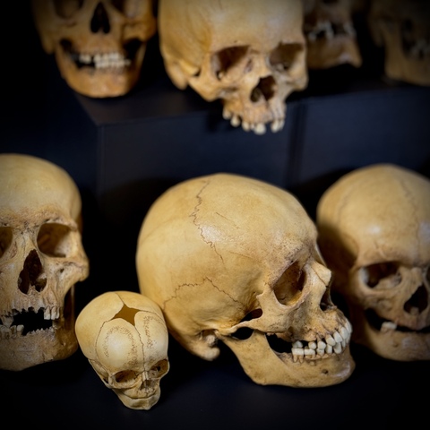 Набор черепов (анатомические модели)