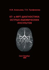 КТ- и МРТ-диагностика острых ишемических инсультов
