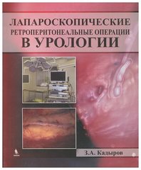Лапароскопические ретроперитонеальные операции в урологии