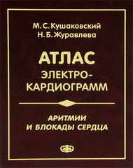 Атлас электрокардиограмм. Аритмии и блокады сердца (Кушаковский)