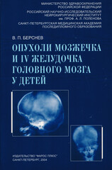 Опухоли мозжечка и IV желудочка головного мозга у детей