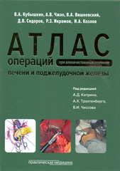 Атлас операций при злокачественных опухолях печени и поджелудочной железы