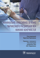 Минимально инвазивное лечение варикозного расширения вен нижних конечностей