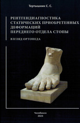 Рентгендиагностика статических приобретенных деформаций переднего отдела стопы. Взгляд ортопеда