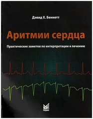 Аритмии сердца. Практические заметки по интерпретации и лечению