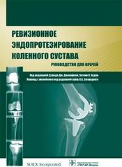 Ревизионное эндопротезирование коленного сустава. Руководство