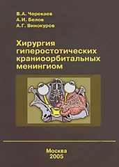Хирургия гиперостотических краниоорбитальных менингиом