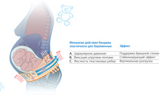 Бандаж эластичный для беременных 
